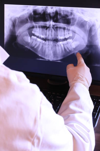Best Emergency Dental Care for Abscessed Tooth in Whidbey Island Station, WA